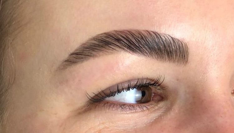 BROW LIFT