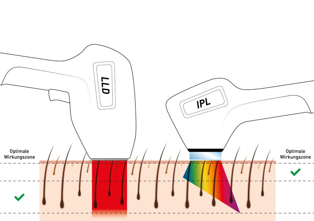 Cala Beauty - IPL Tight & Bright