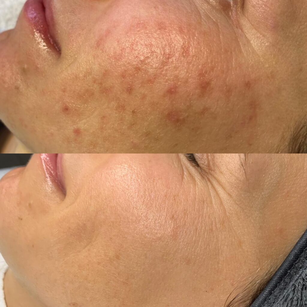 Hautbildverbesserung